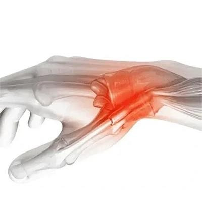 مچ شصت بند نئوپرنی آتل دار برند تسکین طب