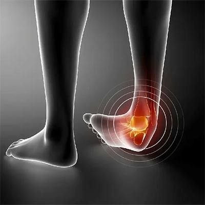 قوزک بند نئوپرن فنردار با کش ساپورت برند تسکین طب